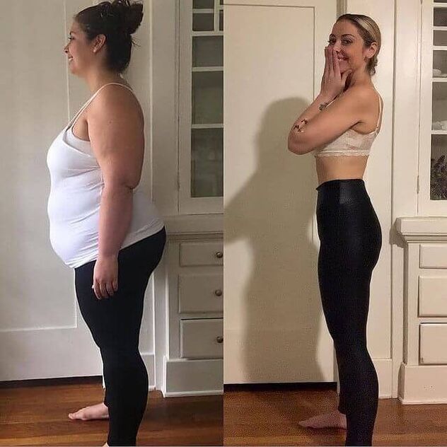 Woman before and after receiving absolute